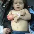 First Image