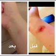 الصورة الأولى