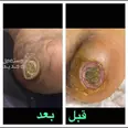 الصورة الأولى
