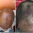 الصورة الأولى