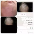 الصورة الأولى